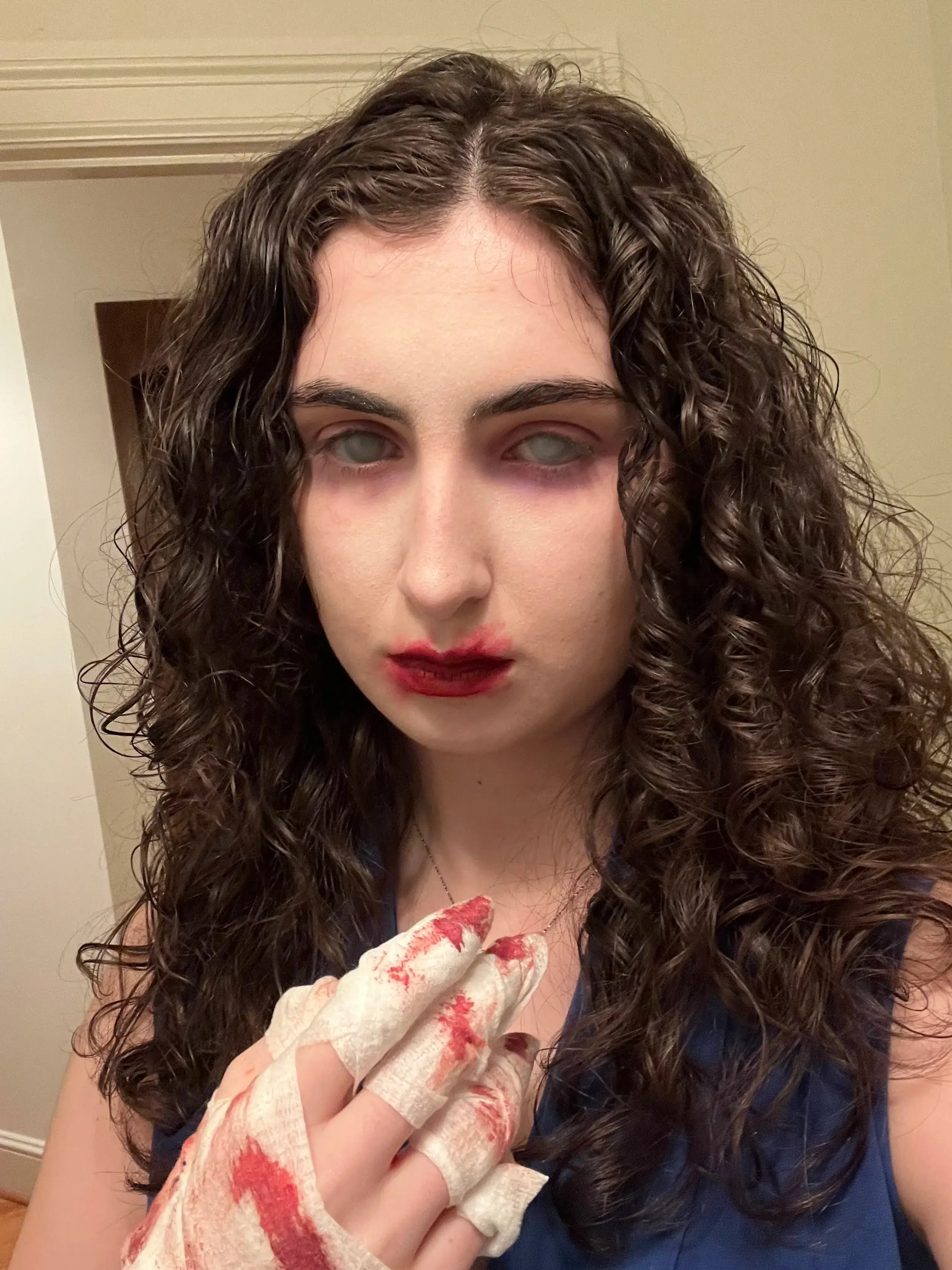 Pale woman with red-rimmed eyes holding up bloody, bandaged hands