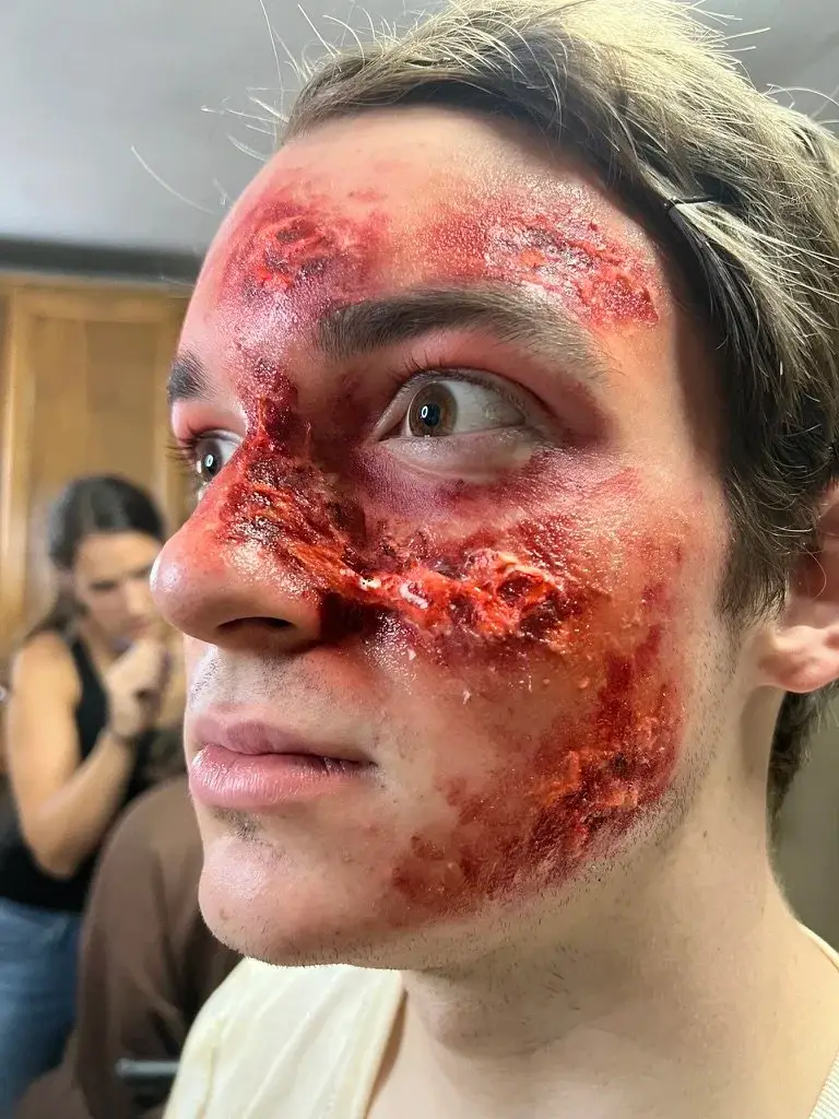 Burned and rotting flesh texture covering half of a face