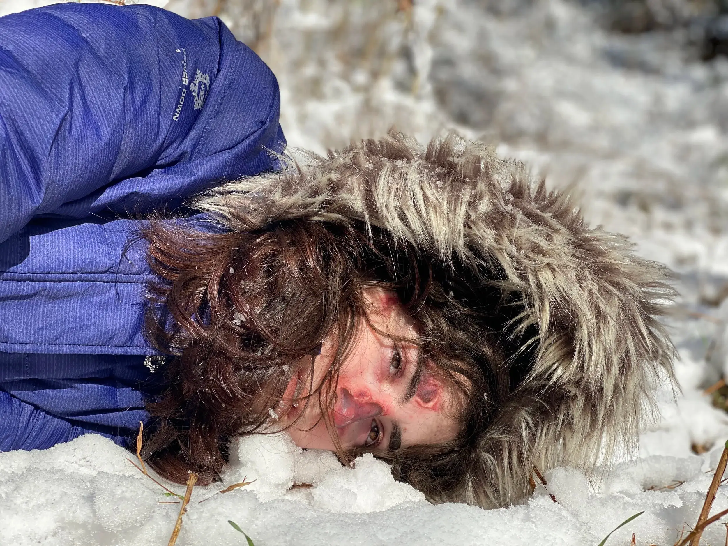 Frozen body in a parka lying in snow, skin mottled blue and red