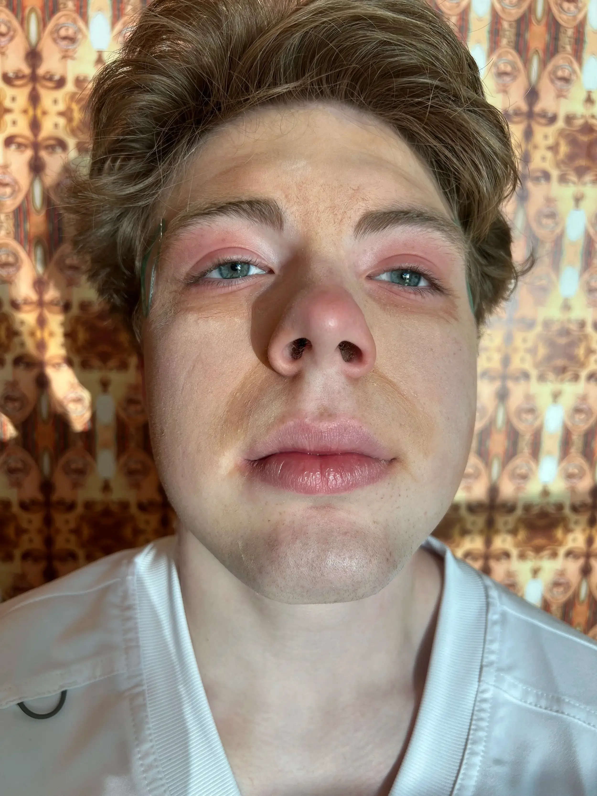 Pale, clammy illness makeup with reddened eyes and nose
