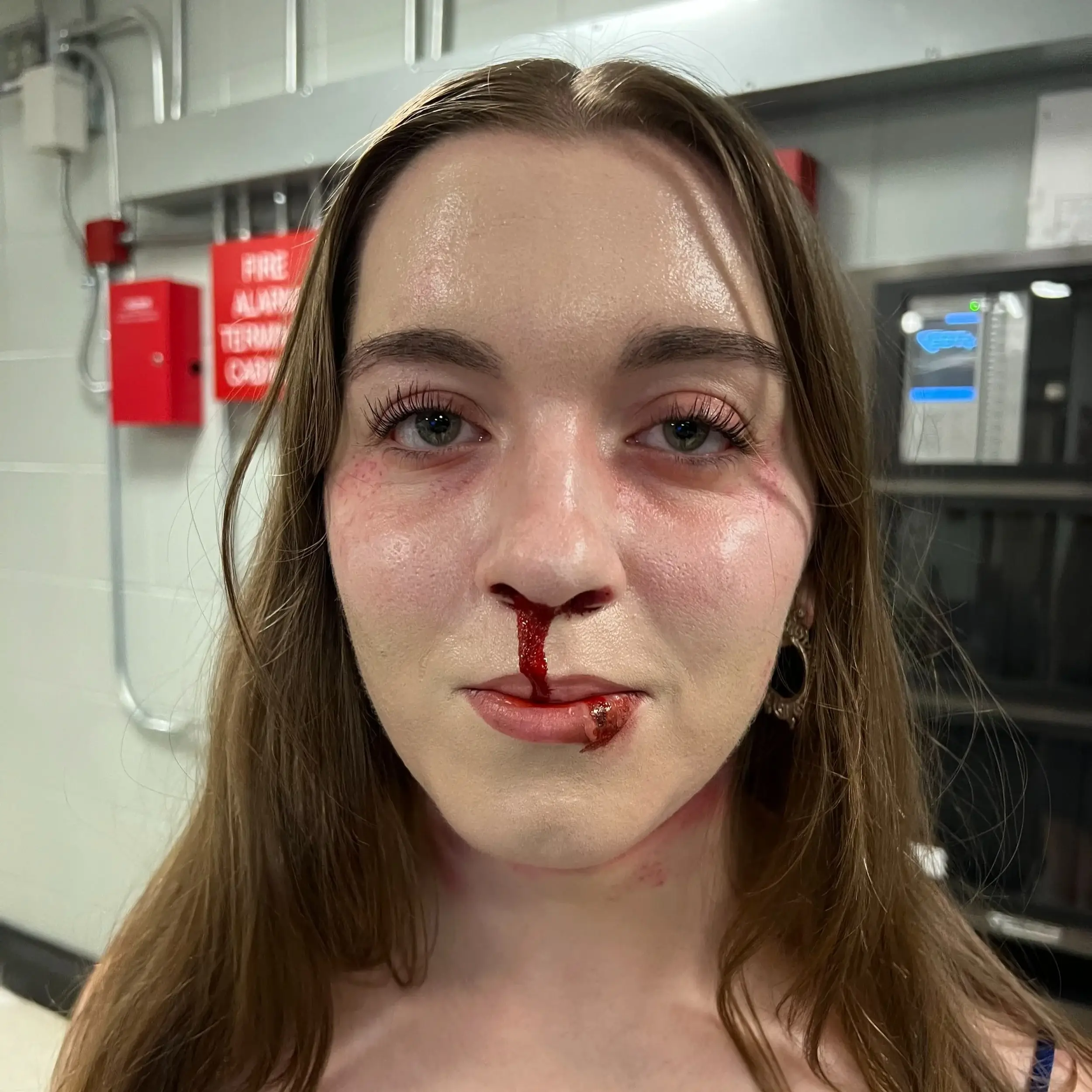 Fresh nosebleed running over the lips, with reddened eyes