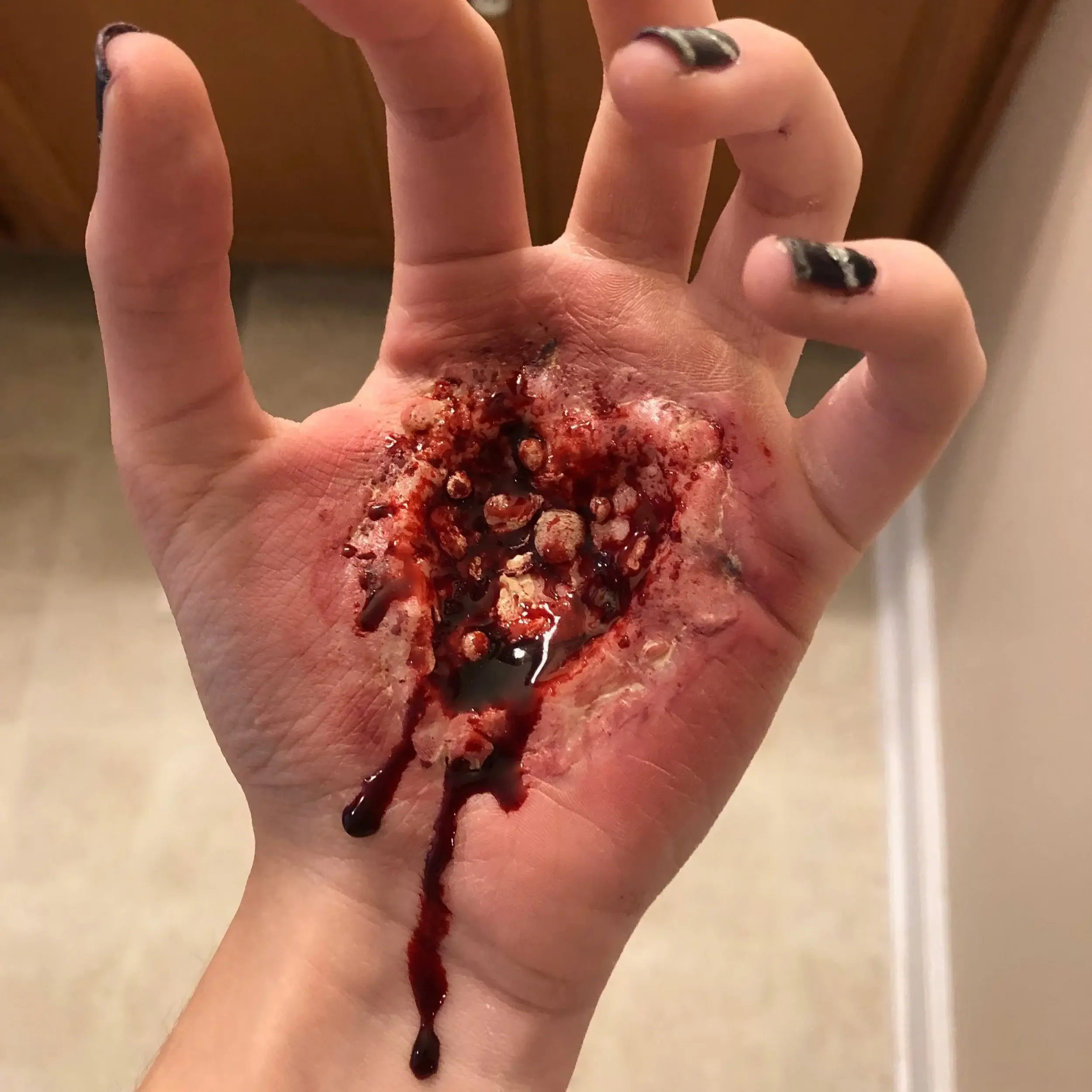 Deep open wound torn through the palm of a hand, blood running to the wrist