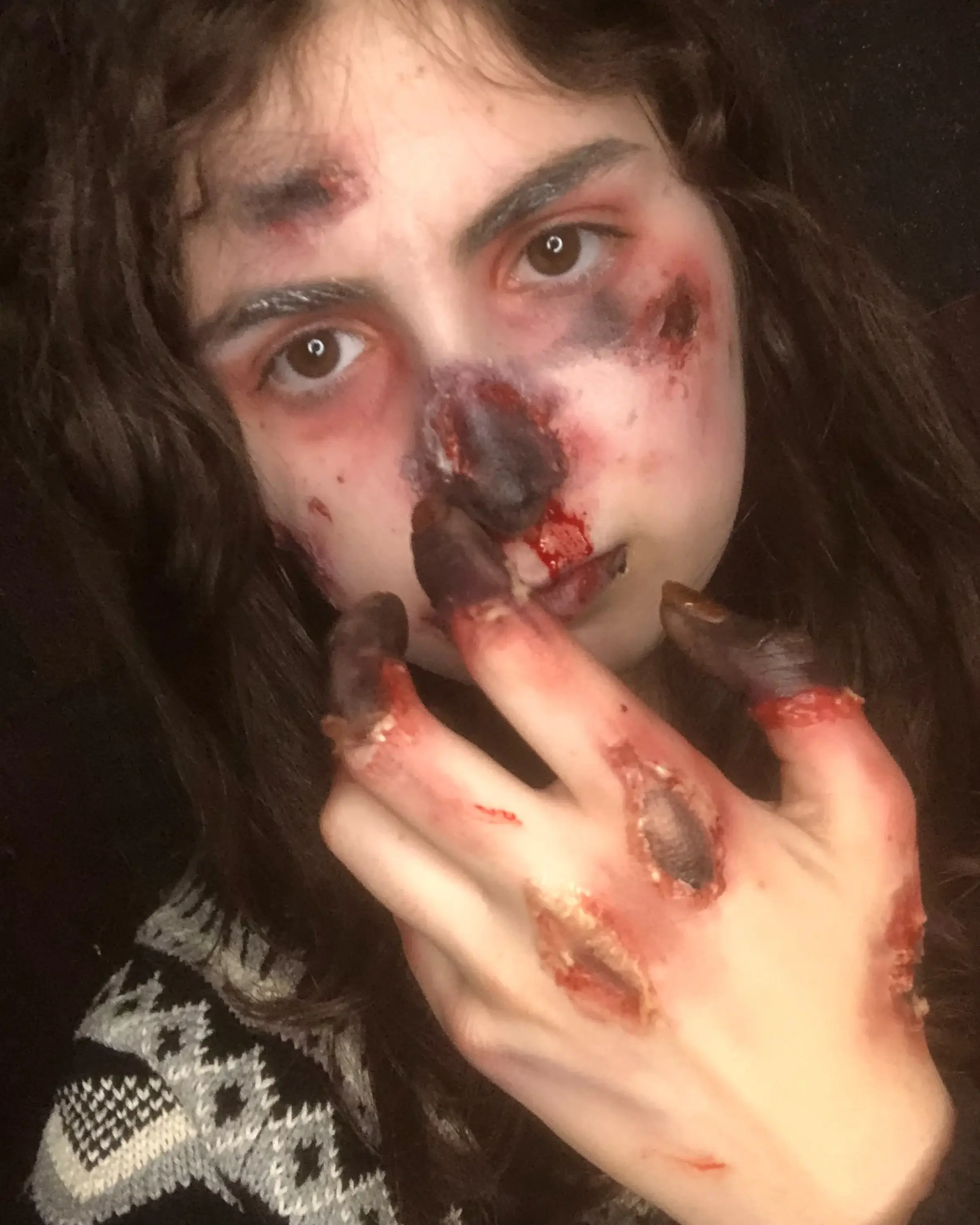 Blackened, rotting nose and fingertips with bruised eye sockets
