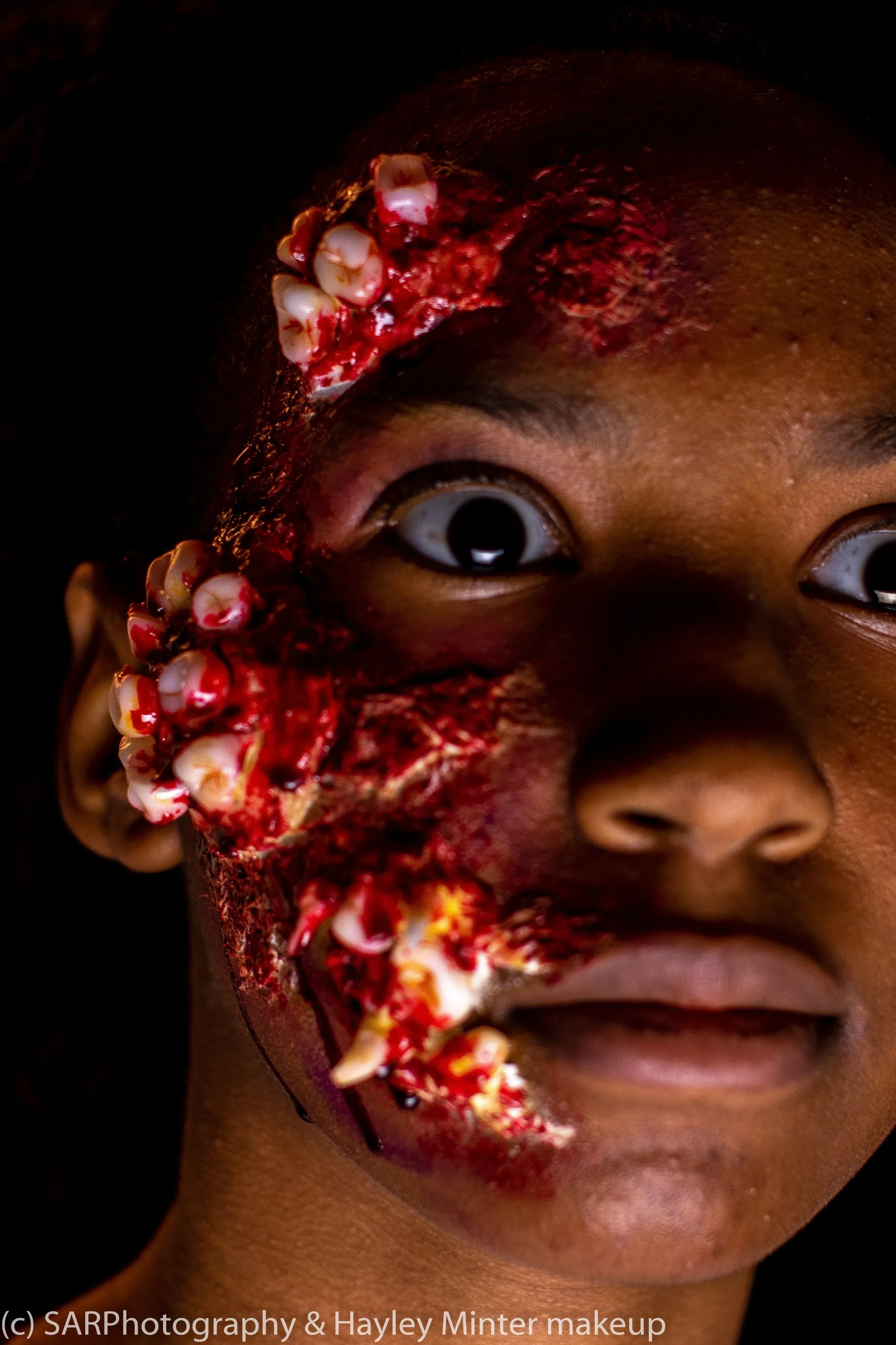 Clusters of teeth and raw tissue erupting from one side of a face, lit from the side against black